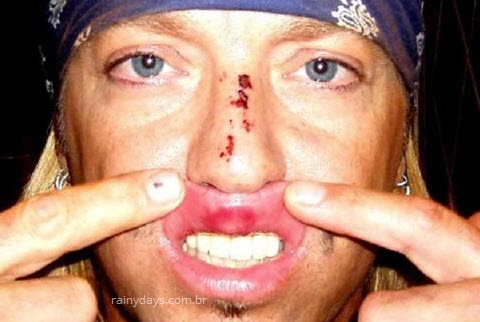Bret Michaels cai e quebra nariz no palco do Tony Awards