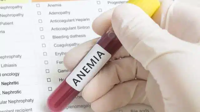 Tratamento caseiro para anemia