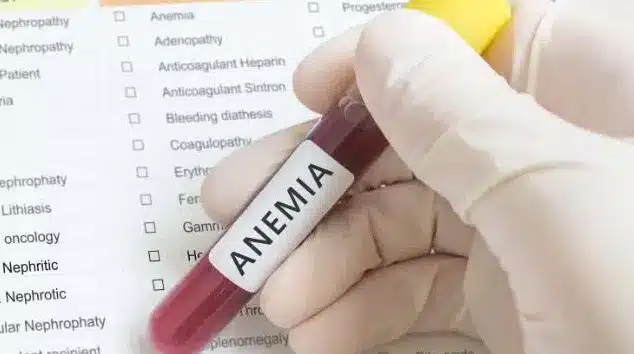 cuidar de anemia em idosos e crianças